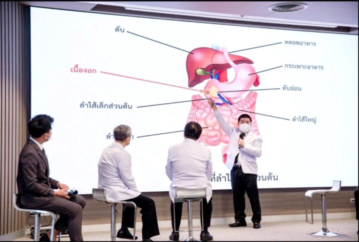 诗丽叻医院泰国首次多脏器移植获成功